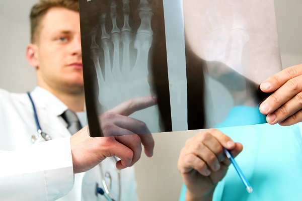 Male doctors looking at x-ray of foot