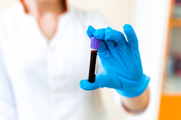 Testing Blood Sample In The Hand Of A Female Technician In The L